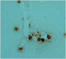 Immunohistochemistry of brain