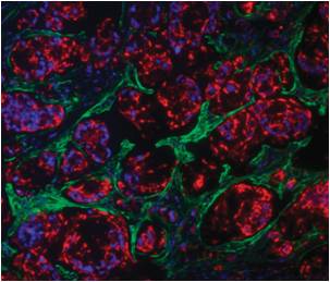 Myofibroblasts 