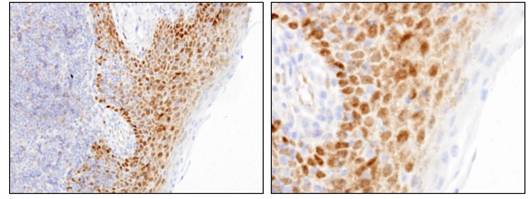 ANTIBODY ANTI-FOXP2, CLONE 73A/8
