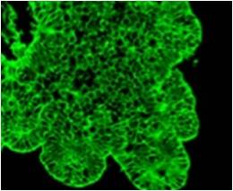 AUA1 stained SW1222 cells